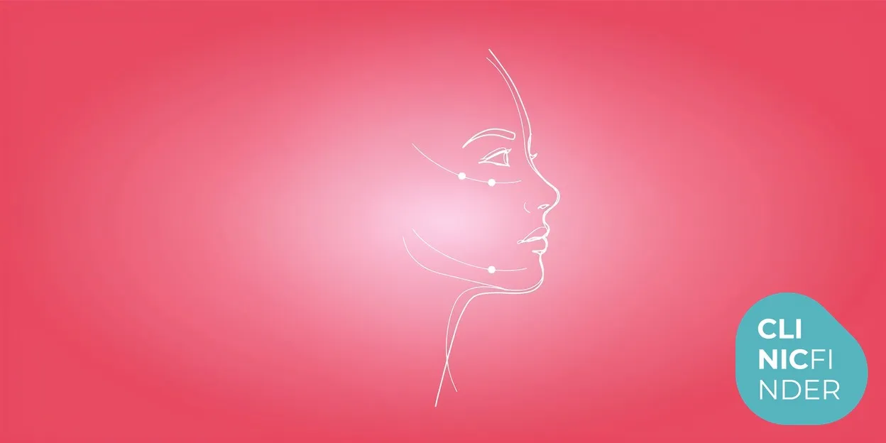White line-art illustration of a serene face in profile with subtle marking points along the cheekbone and jawline, symbolising structural dermal filler restoration