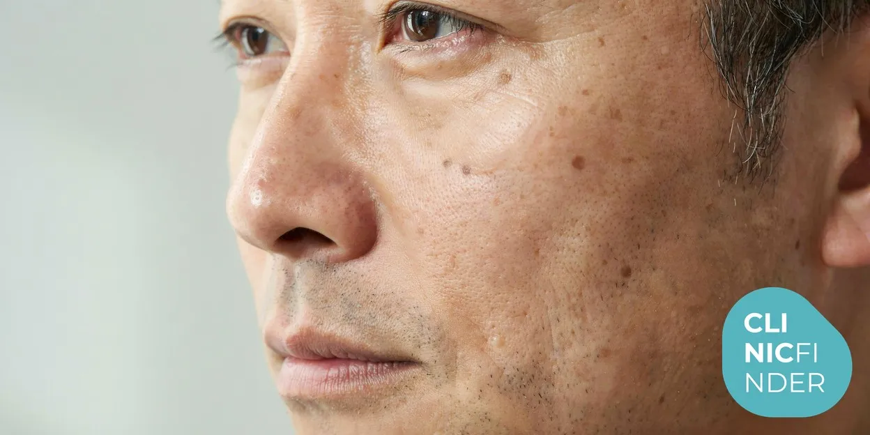 A close-up of calm, clear, healthy skin on a relaxed face in soft natural daylight, reflecting the gradual glow LED aims to support