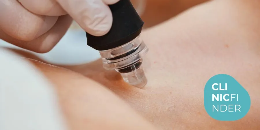 Gloved hand pressing a microneedling device to a client’s skin